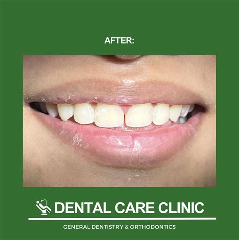 Pasvil Dental Care Clinic .